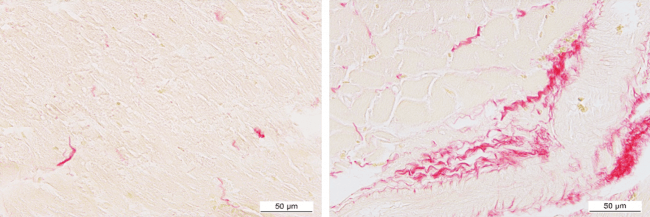 Microfotografía representativa de secciones de corazón de ratas controles y ratas obesas, con tinción de rojo sirio que marca el contenido de colágeno. / Gutiérrez-Tenorio et al