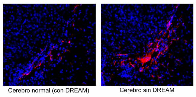 Nuevos mecanismos que regulan el número de células cerebrales durante el desarrollo embrionario