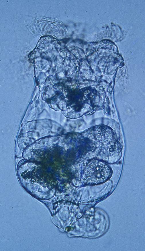 Nuevos pasos en la diferenciación de poblaciones de los invertebrados del plancton