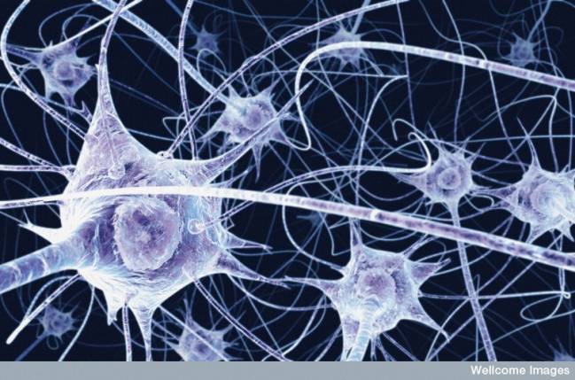 Objetivo: diagnosticar el alzhéimer con imágenes del cerebro