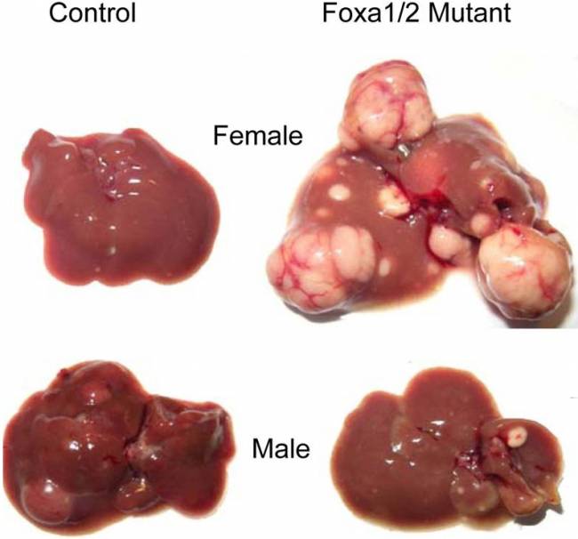 Pequeños cambios en el genoma explican las diferencias sexuales en el cáncer de hígado