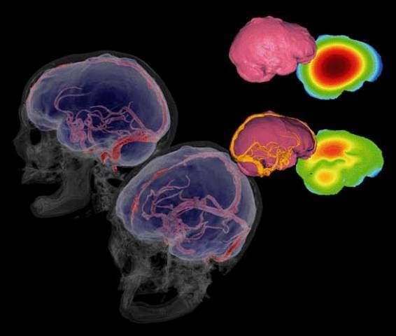 Presentan un método pionero para conocer la fisiología cerebral de los fósiles