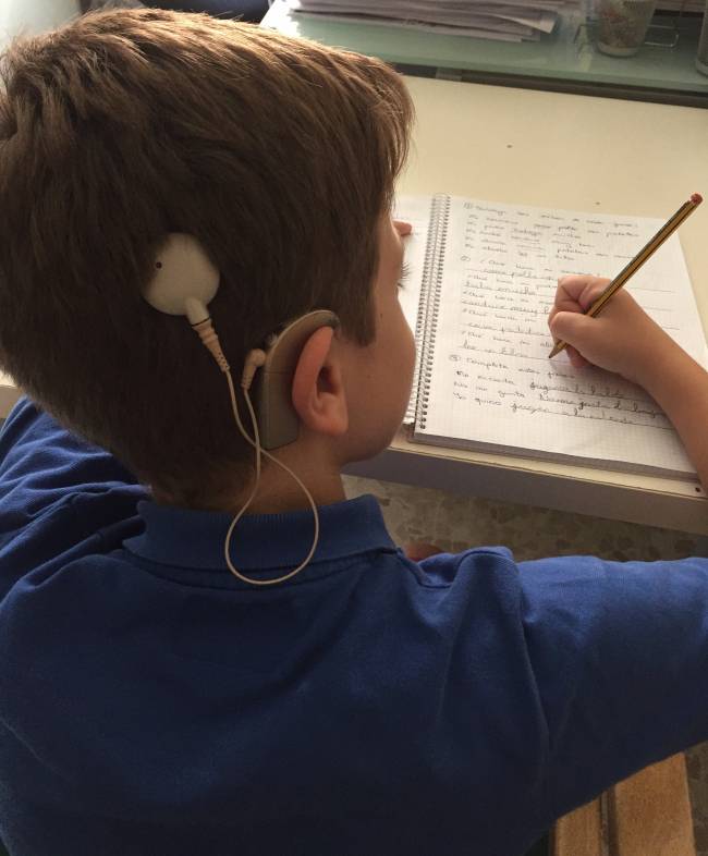 ¿Qué condiciona el aprendizaje en niños con implante coclear?