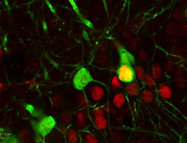 Recaer en el consumo de cocaína no es falta de voluntad: la droga reconfigura el cerebro 