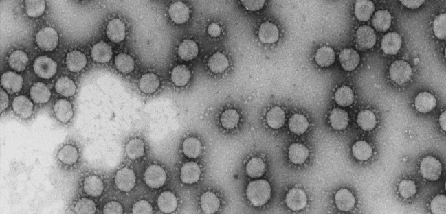 Resultado prometedor de un fármaco contra el mieloma que logra frenar un coronavirus humano 
