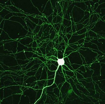 ¿Se pueden "rejuvenecer" las neuronas ancianas?