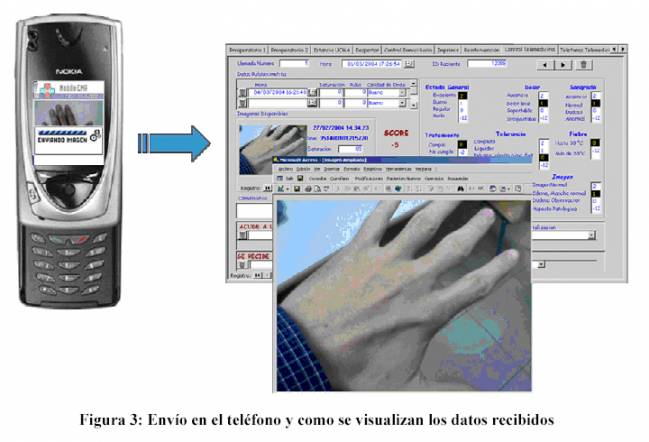 Tecnologías móviles para seguir la evolución postoperatoria de los pacientes desde casa
