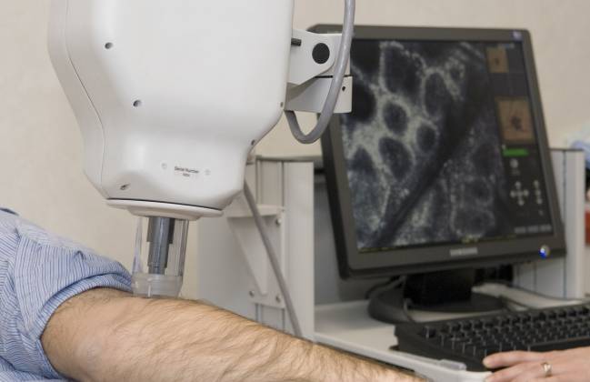 Un estudio identifica un oncogén que causa cáncer de piel y proliferación anormal de células madre