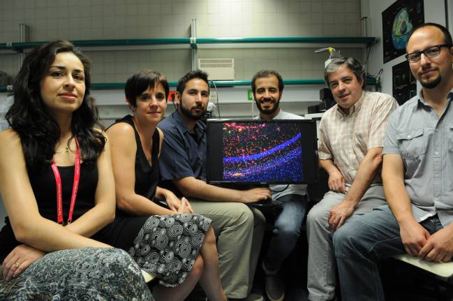 Un medicamento contra la esclerosis múltiple podría tener aplicación en la enfermedad de Huntington