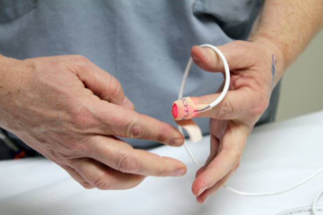 Un nuevo dispositivo portátil cuenta leucocitos a través de la piel
