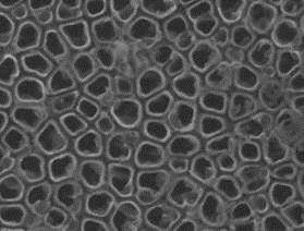 Un nuevo método reduce el riesgo de infección de las prótesis de titanio 