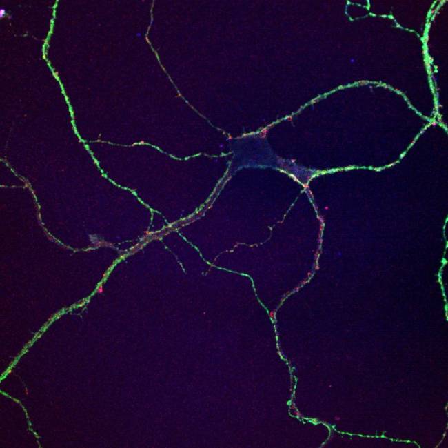 Una aproximación al estudio  de la Hiperplexia humana