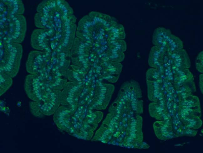 Flora intestinal
