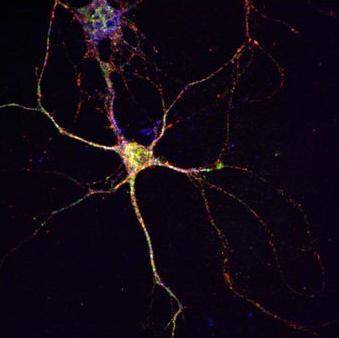 Una investigación analiza nuevas proteínas relacionadas con la muerte de neuronas
