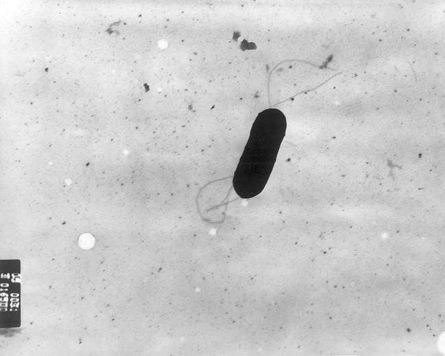 Una listeria inofensiva y radiactiva lucha contra la metástasis en el cáncer de páncreas