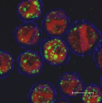Una nueva metodología permite observar bacterias en el interior de microalgas marinas