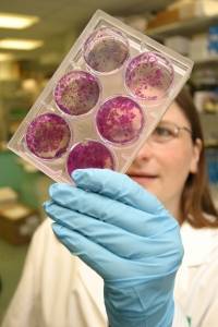 Una nueva técnica estudia la genética del cáncer de mama