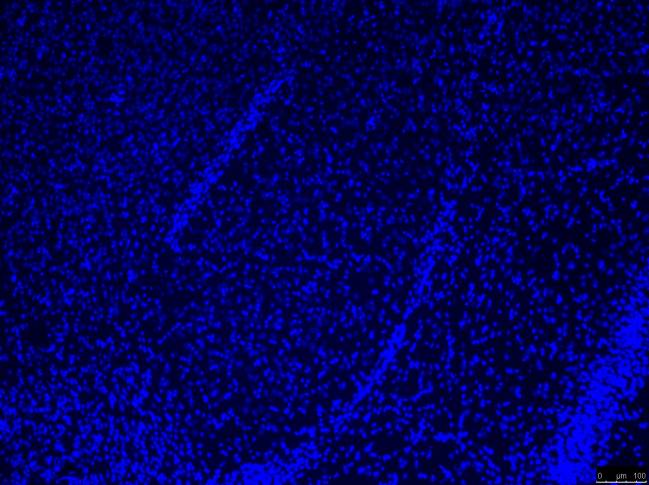 Imagen de microscopía de una amígdala de ratón.