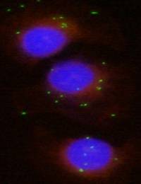 Ya es posible diferenciar cepas patógenas y no patógenas de la bacteria Haemophilus parasuis sin recurrir a desafíos en animales
