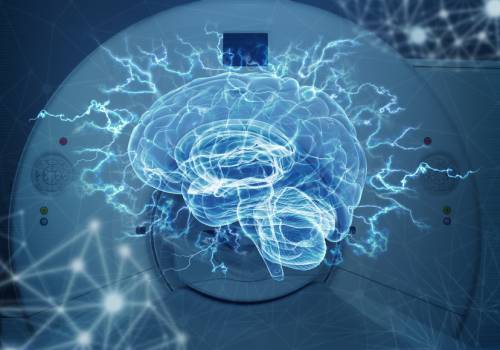 Imágenes del cerebro refutan una teoría de los años 60 sobre el dominio del lenguaje