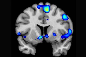 Diversas áreas del cerebro, activas durante la experiencia religiosa de los participantes. / Jeffrey Anderson