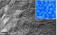 Imágenes de microscopía SEM que muestran la mineralización. / Universidad de Valladolid