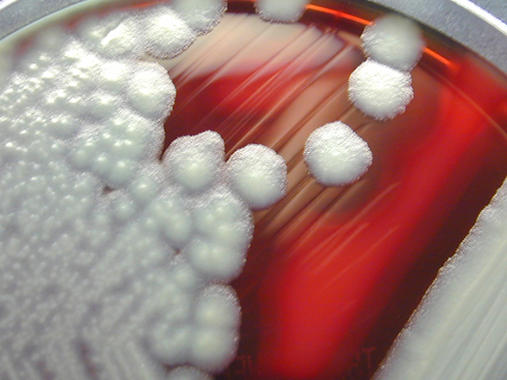 <p><em>Bacillus cereus</em>. Foto: Marco Tolo.</p>
