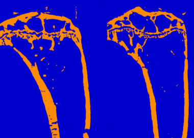 <p class=" text-left">A la izquierda, imagen histológica de un hueso de ratón sano. A la derecha, hueso al que se le ha retirado el gen <em>JunB</em> de la epidermis y en el que se observa pérdida de tejido. <strong>/ </strong>CNIO</p>
