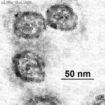Descubren un nuevo tratamiento antiviral para la hepatitis C