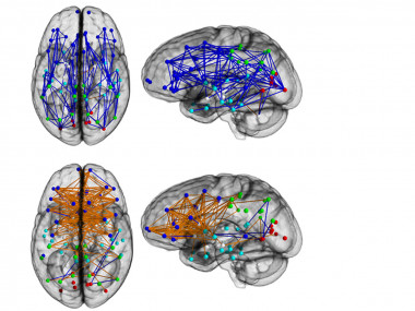 En la parte superior el cerebro masculino, en la inferior el femenino. En azul, las conexiones en un mismo hemisferio, en naranja los circuitos entre hemisferios- PNAS