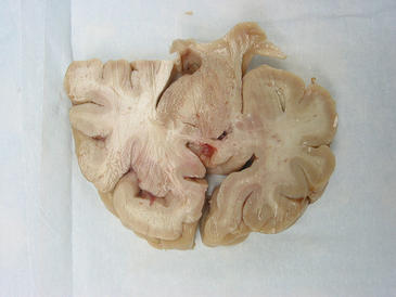 El miedo del cerebro está equipado con un sensor de ahogamiento integrado