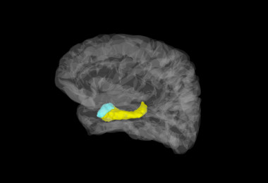 <p>Imagen cerebral en la que aparecen coloreadas la amígdala (azul) y el hipocampo (amarillo). / Stephan Moratti</p>