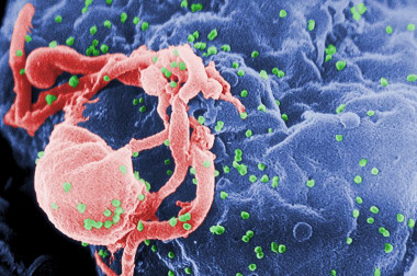 <p>Viriones de VIH-1 (en verde) ensamblándose en la superficie de un linfocito. / <a href="https://commons.wikimedia.org/wiki/File:HIV-budding-Color.jpg" target="_self">Wikipedia</a></p>