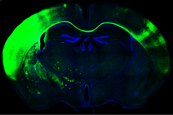 <p>Sección de cerebro de ratón al microscopio. En verde las neuronas que cruzan de un hemisferio a otro formando el cuerpo calloso. / Laboratorio de Marta Nieto. CNB-CSIC</p>