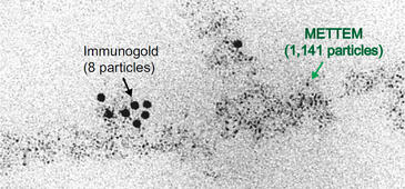 Detección de proteínas por microscopía electrónica Detección de proteínas por microscopía electrónica