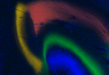 <p>Las tres rutas en el hipocampo parecen estar ligadas a diferentes aspectos del aprendizaje: la formación de recuerdos (verde), su recuperación (amarillo) y el olvido (rojo).</p>