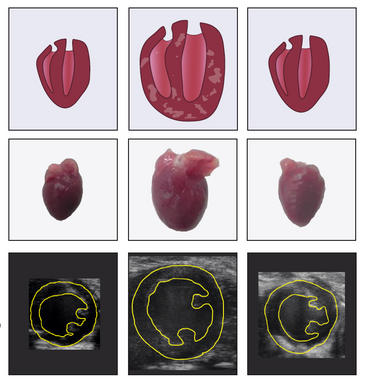 Corazón y sus lesiones