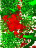 Un nuevo método visualiza las metástasis en el cerebro 