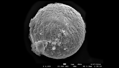 <p>Uno de los 60 micrometeoritos extraidos de un antiguo lago en Pilbara, Australia. / Andrew Tomkins</p>