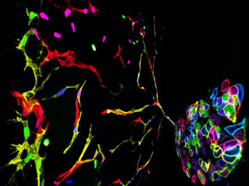 <p>Representación artística de un grupo de células madre en las que se ha inducido la expresión de un mosaico genético fluorescente. Se pueden diferenciar células endoteliales que migran y se dividen para formar nuevos vasos sanguíneos. / CNIC</p>