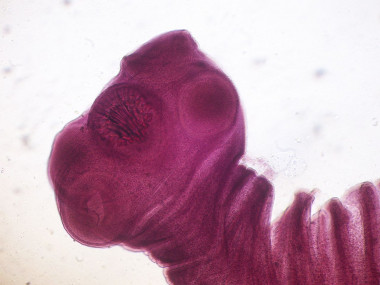 Extremo anterior de Taenia solium, cuyos quistes larvales provocan cisticercosis. / Wikipedia