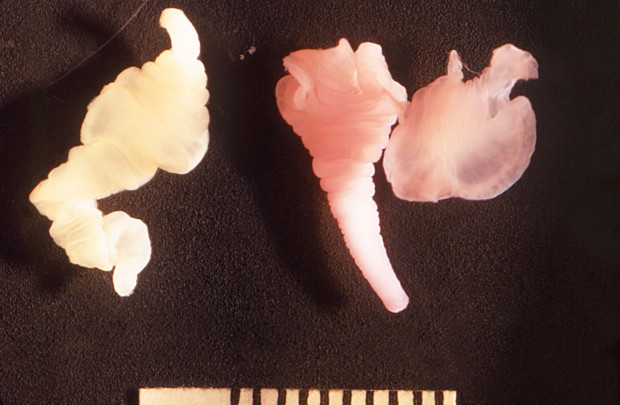 Estos son dos 'Taenia solium' representan las etapas larvales o intermedias de desarrollo de esta tenia porcina. / cdc | dr. George r. Healy, 1973