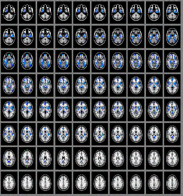 cerebros_PNAS_2