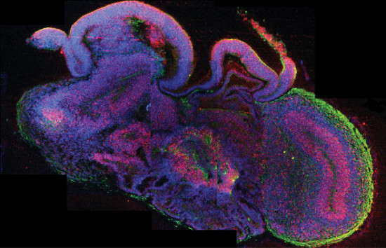 Sección de un organoide cerebral o minicerebro. En rojo se observan células madre neuronales y en verde, neuronas. / Madeline A. Lancaster