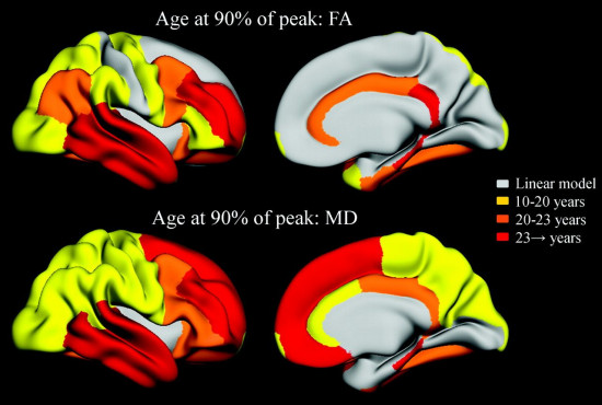 desarrollo cerebro edad