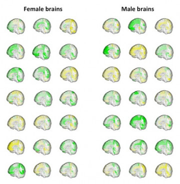 No hay diferencias entre las formas de los cerebros de ellos y ellas. / Zohar Berman, Daphna Joel
