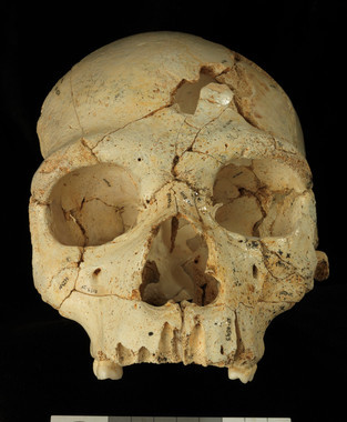 El-primer-caso-documentado-de-asesinato-conocido-en-la-humanidad_image_380