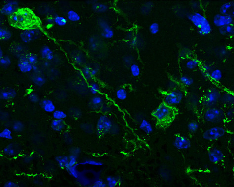 Estimulan-con-laser-las-neuronas-implicadas-en-la-memoria-del-miedo_image_380