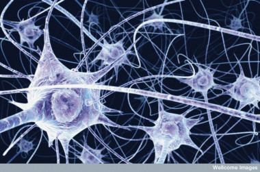 <p>Los problemas cognitivos se deben a defectos en la mielina del sistema nervioso<strong>. </strong>Imagen: wellcome images</p>
