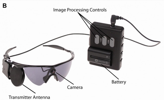 Gafas y dispositivo que forman parte de Argus II. /Second Sight Medical Products